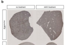 Wen Xue Phillip Zamore, Guangping Gao Cas9-mediated allelic exchange repairs compound heterozygous recessive mutations in mice