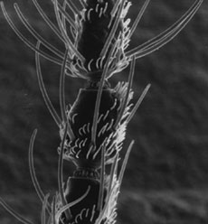 Micrograph of an antenna of female black fly