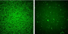 Zika Virus Screen: Infection Level in Green