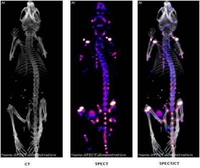 Spect CT