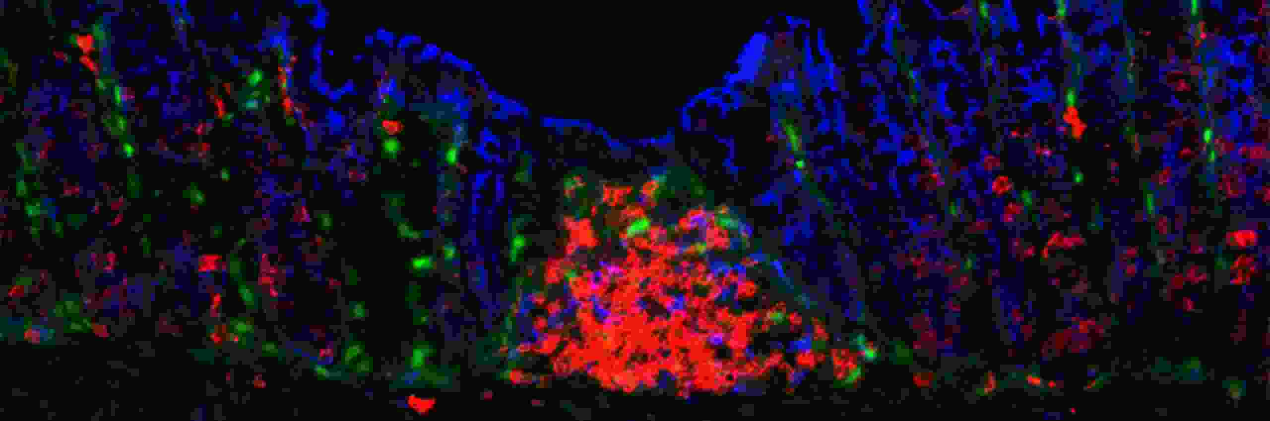 B-cells aggregates in Tertiary Lymphoid Structures (TLFs)