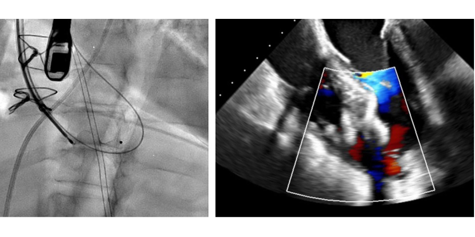 Interventional Curriculum