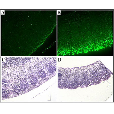 Increased p53 apoptosis in Mdm2-ablated mice (TUNEL stain).