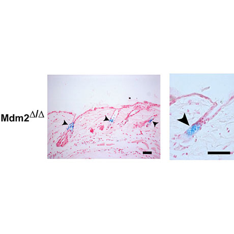 Premature senescence of epidermal stem cells.