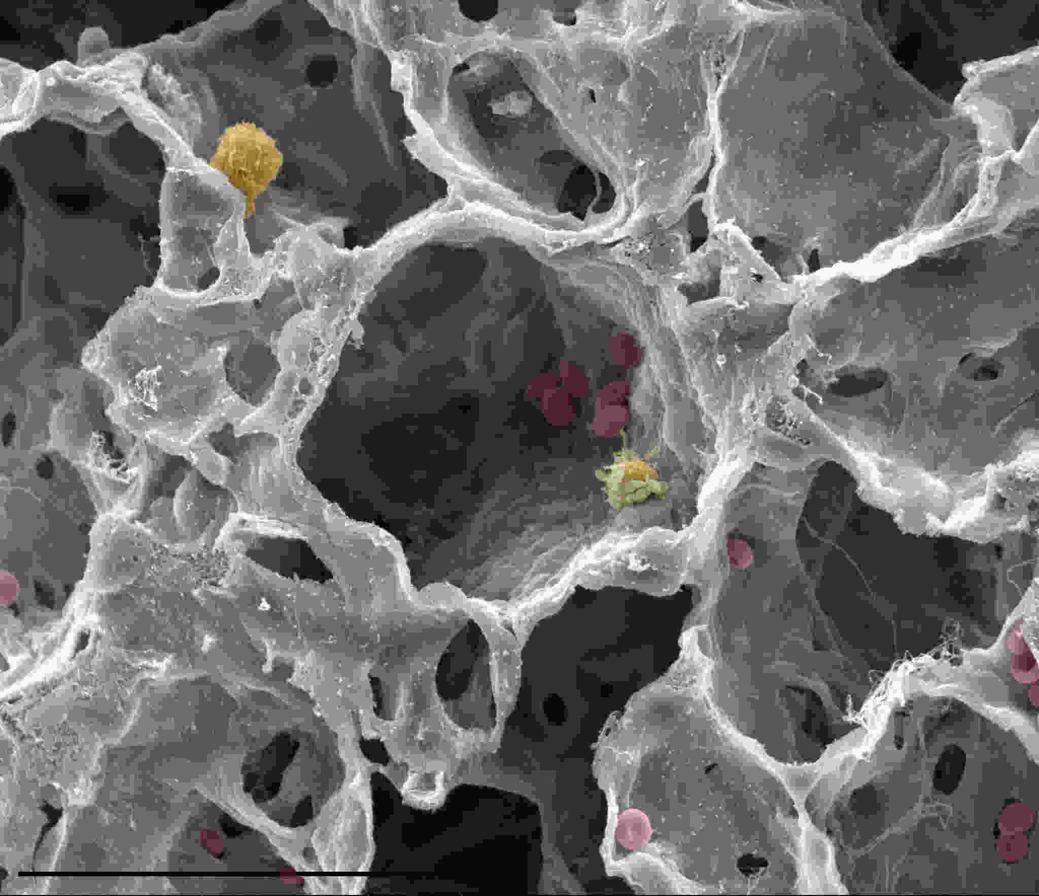 Lung cross section