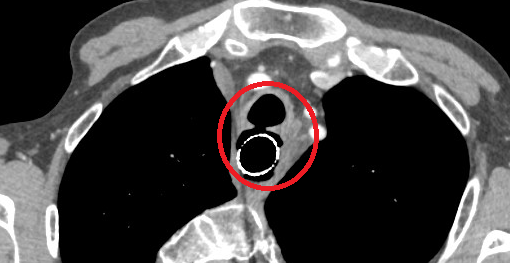  Gastroenterology