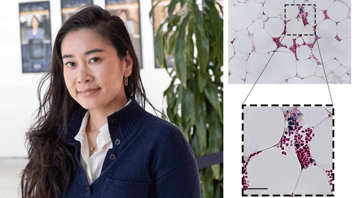 Nguyen Lab Finds a Distinct Class of Stem Cells  Develop from Yellow Bone Marrow in Humans