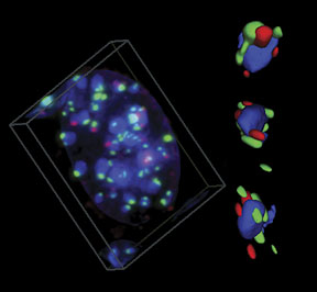 3D-image-composite BRCA