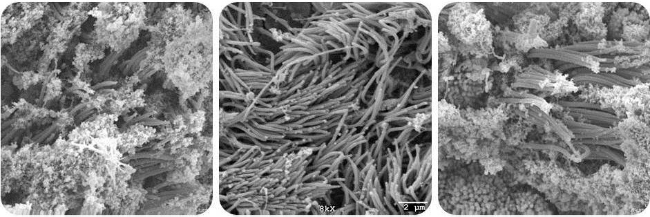 With our research in Cystic Fibrosis, we use gene therapy to express CFTR in the lung or correct the T-cell phenotype by gene therapy or calcium channel modulators.