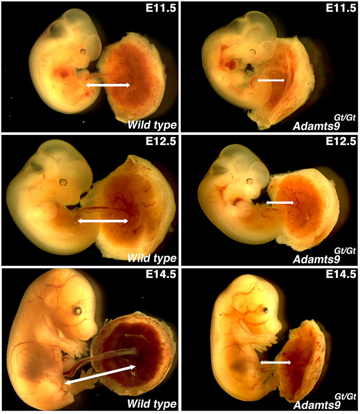 Umbilical1