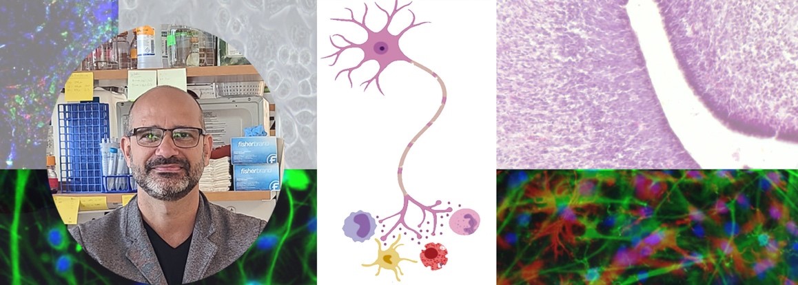 Neuroimmune Interactions Lab header photo