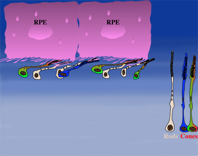 Onset of cone degeneration