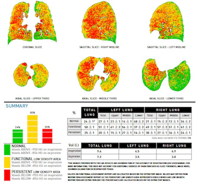 CTI Research 4