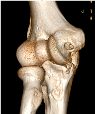 routine CT