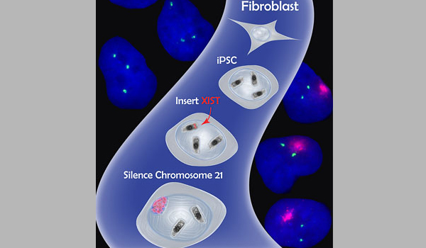 trisomy 21 research