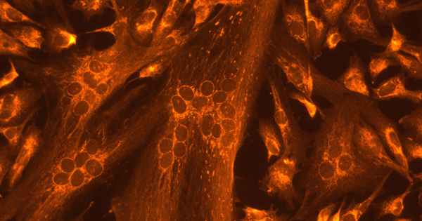 facioscapulohumeral muscular dystrophy