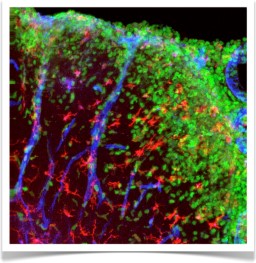 Monocyte infiltration in spinal cord