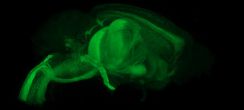 cleared GFP brain