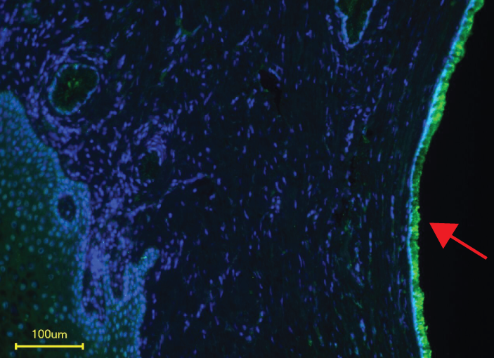 Siglec-11 receptors (red arrow) are expressed on human cervical epithelia, the main infection site of the gonococcus