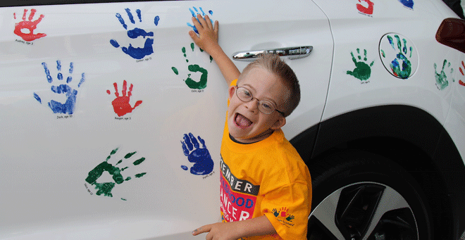 Liam Fitzgerald Hyundai Hope on Wheels handprint