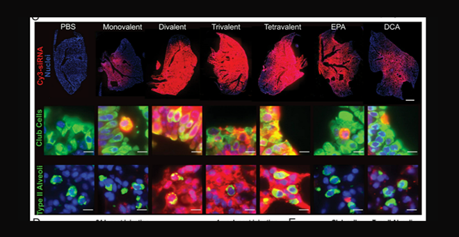 UMass Chan scientists deliver siRNA therapy to lung